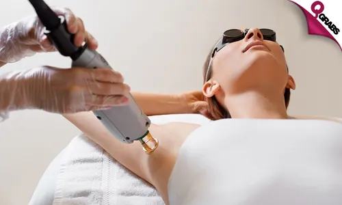 Laser Hair Removal Sessions at Westbay!